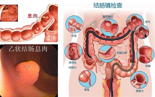 萎縮性胃炎真的“很嚇人”？看完這“七個(gè)事實(shí)”你就明白了